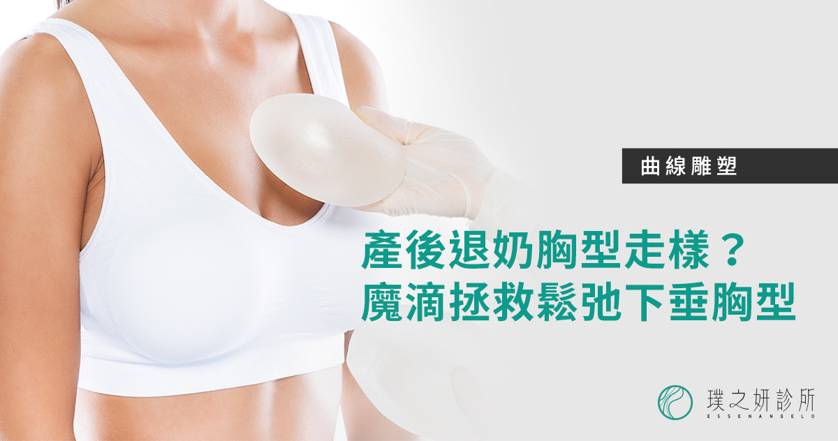 曲線雕塑 產後退奶胸型走樣 魔滴隆乳拯救鬆弛下垂胸型 璞之妍診所essenangelo